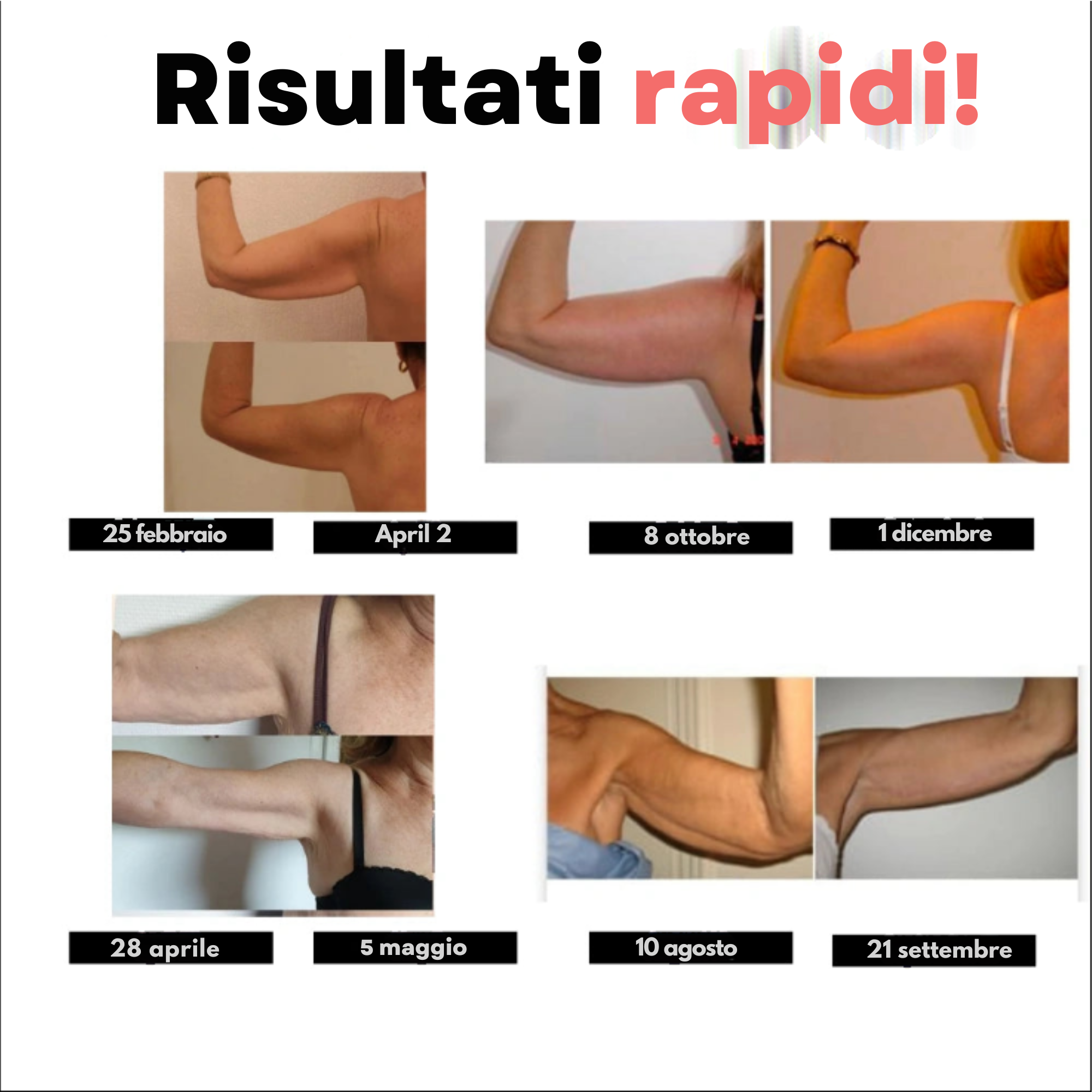 FittaBella 3D Sculpting Sleeves – Adeus aos braços flácidos